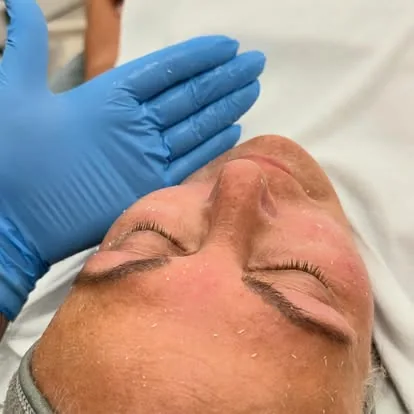 Advanced Skin Treatments training course